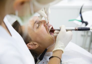 Periodontal Treatment